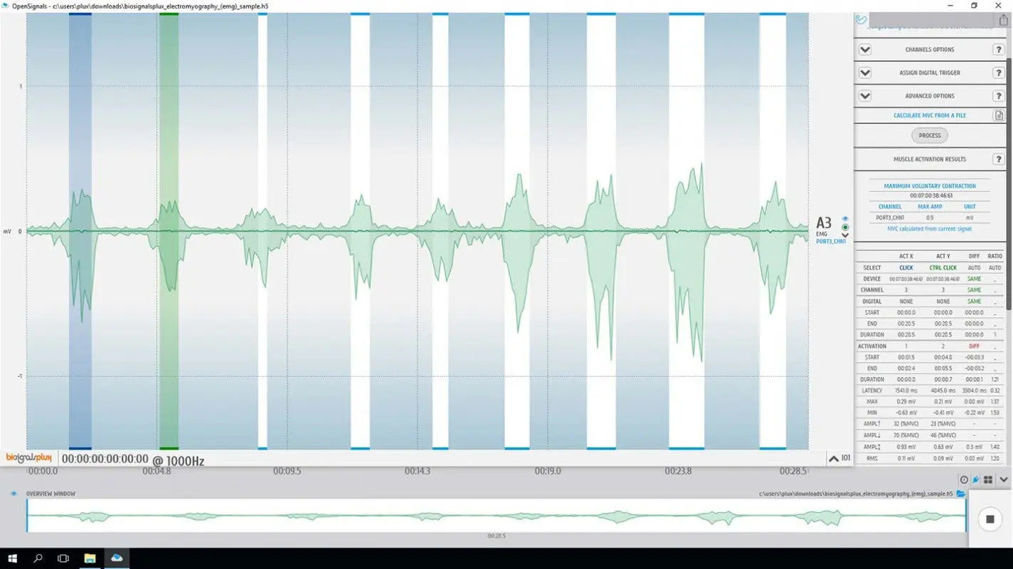 bitalino-software-add-ons-analyse-emg-opensignals-licence image 2