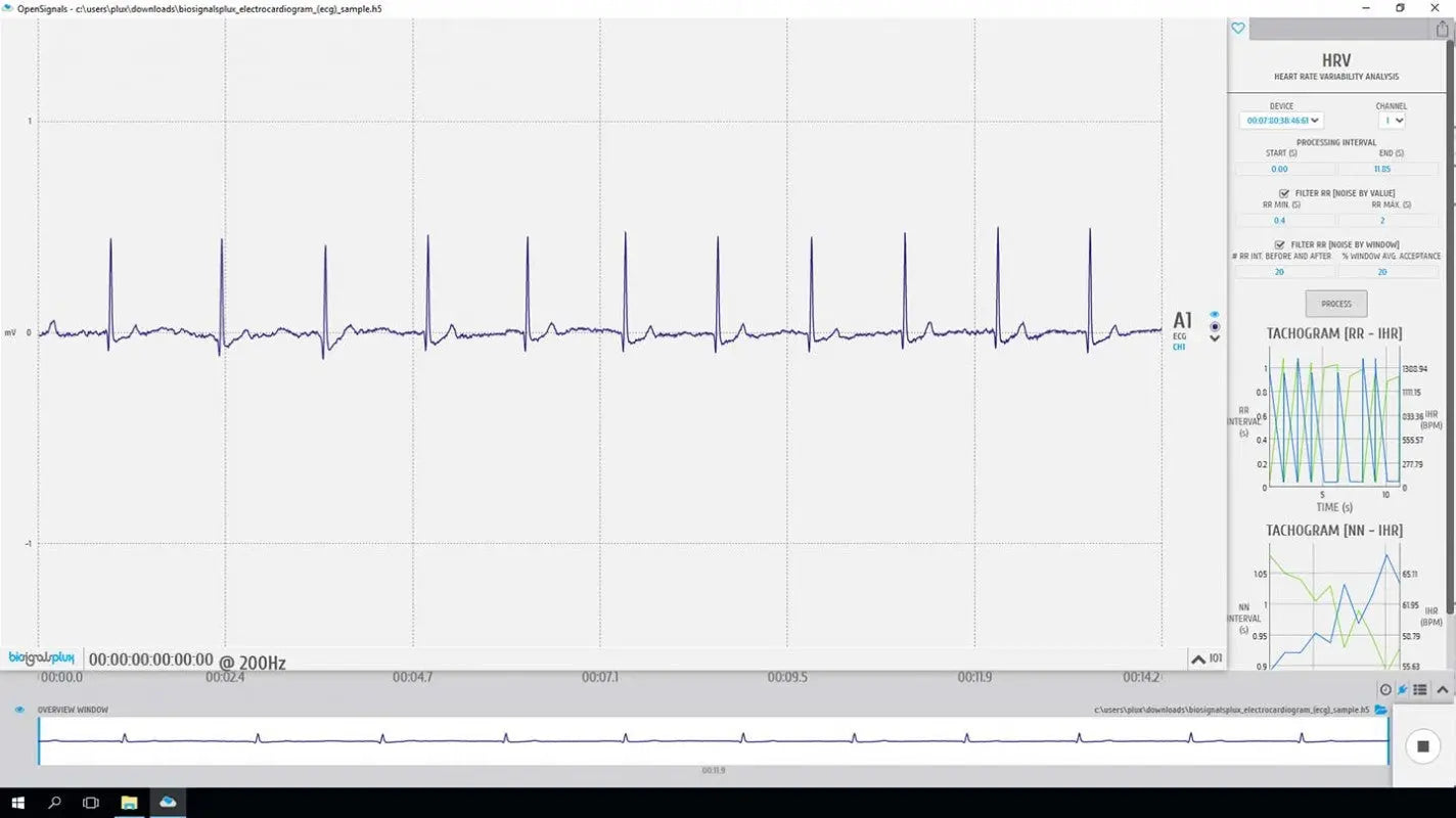 bitalino-software-add-ons-hrv-logiciel-variabilit-cardiaque image 2