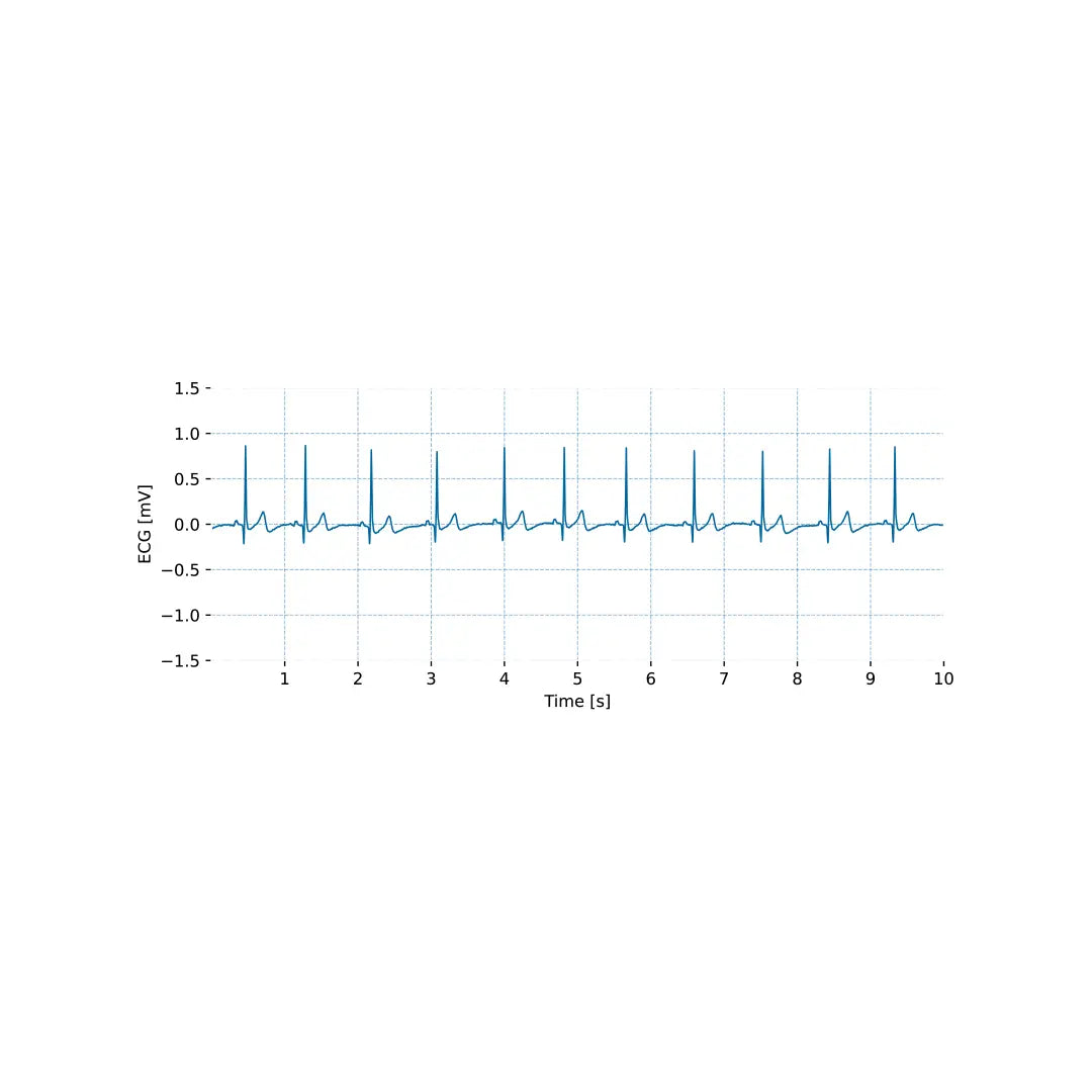 bitalino-ecg-sensor-capteur-ecg-lectrocardiographie-sport image 8