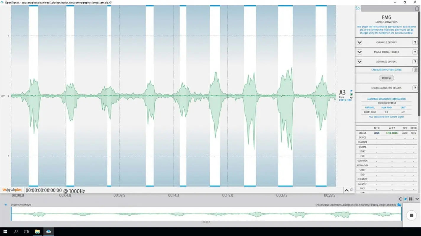 bitalino-software-add-ons-analyse-emg-opensignals-licence image 3