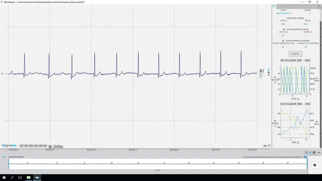 bitalino-software-add-ons-hrv-logiciel-variabilit-cardiaque image 1