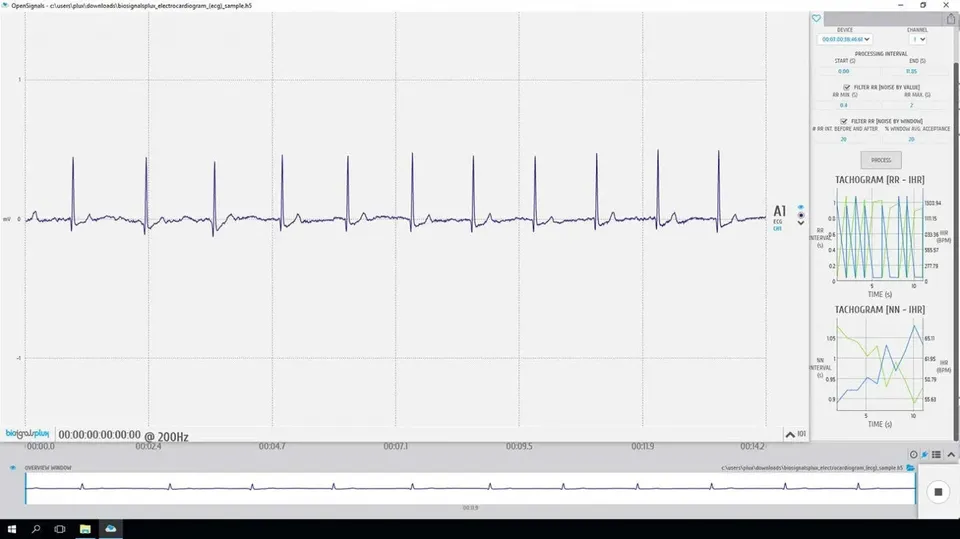 bitalino-software-add-ons-hrv-logiciel-variabilit-cardiaque image 1