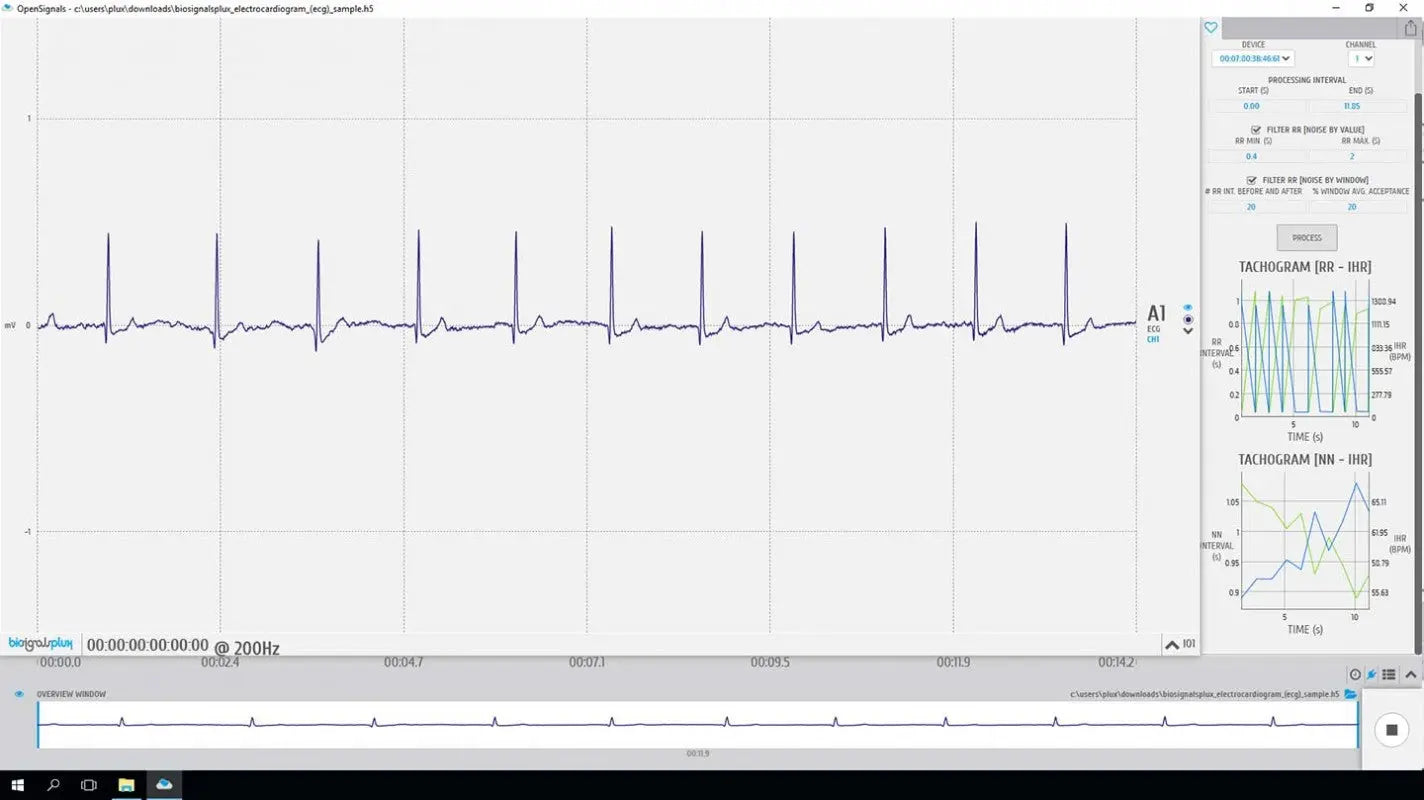 bitalino-software-add-ons-hrv-logiciel-variabilit-cardiaque image 1